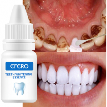 Teeth Whitening Seru…